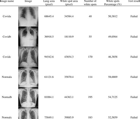 how long is the validity of x ray result in the philippines